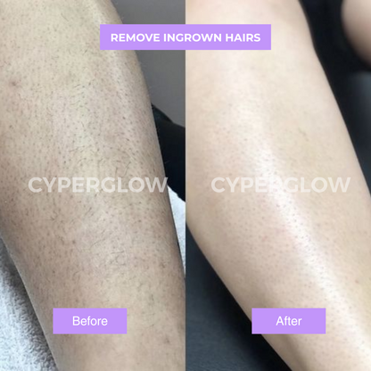 CyperGlow™ - Cyperus Rotundus Skin Serum