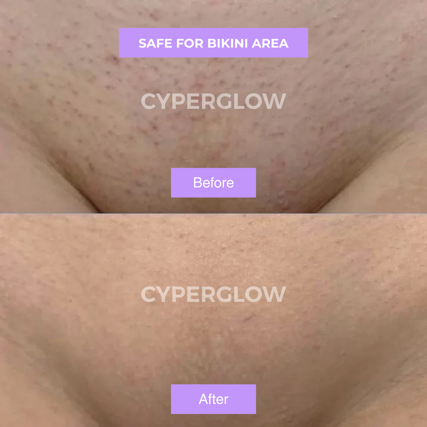 CyperGlow™ - Cyperus Rotundus Skin Serum