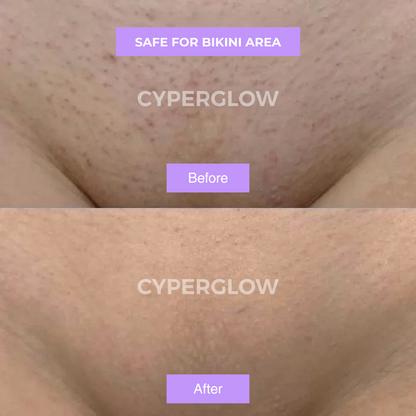 CyperGlow™ - Cyperus Rotundus Skin Serum