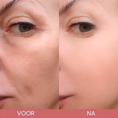 CocoBeauty Peel Shot Glow Rijst Ampul Duo